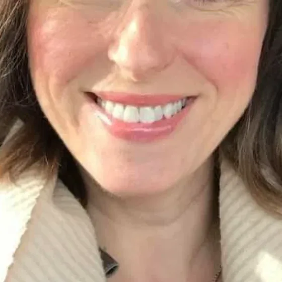 Sourire dents plus saines après