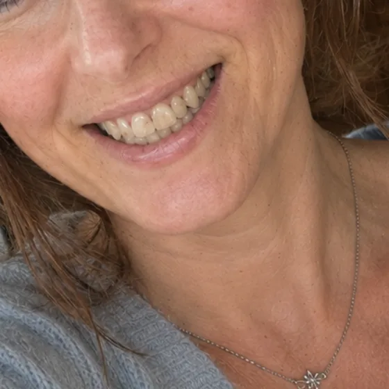 Sourire dents ternes avant